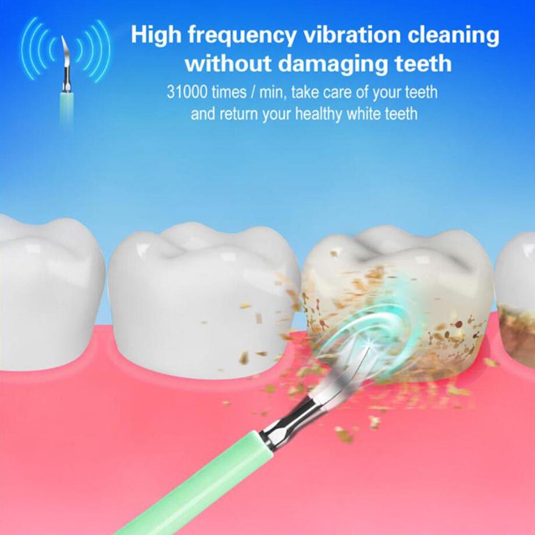🦷✨ Limpiador Dental Ultrasónico con Cepillo y Carga USB – ¡Sonríe sin sarro!