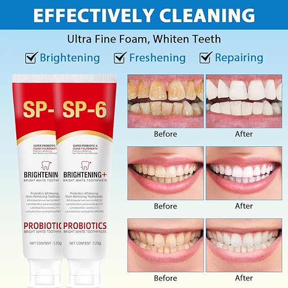 🦷✨ SP-6 Probiotic Brightening Toothpaste Sonrisa Brillante