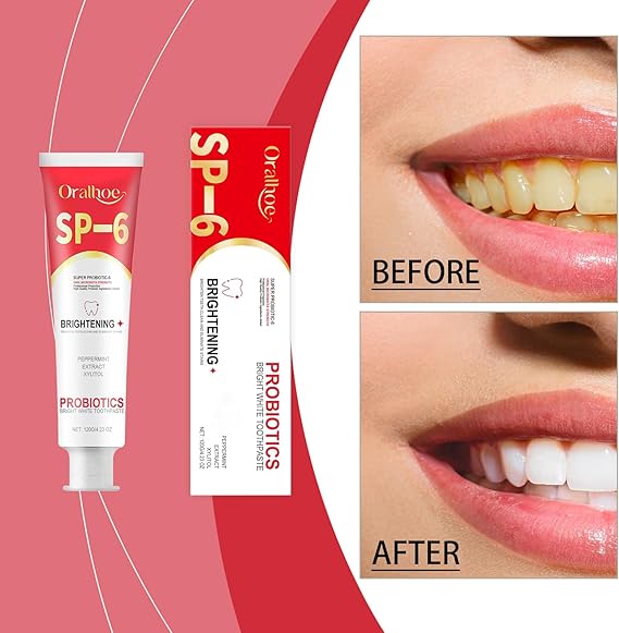 🦷✨ SP-6 Probiotic Brightening Toothpaste Sonrisa Brillante