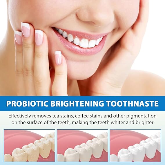 🦷✨ SP-6 Probiotic Brightening Toothpaste Sonrisa Brillante
