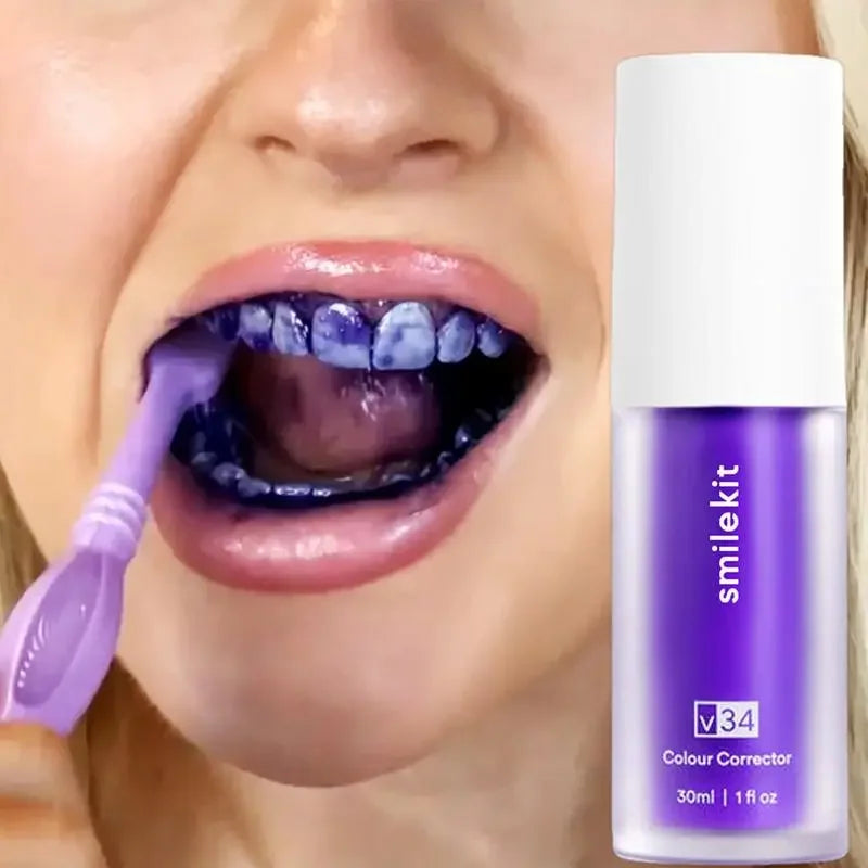 Sonrisa Radiante al Instante: V34 Blanqueador Dental